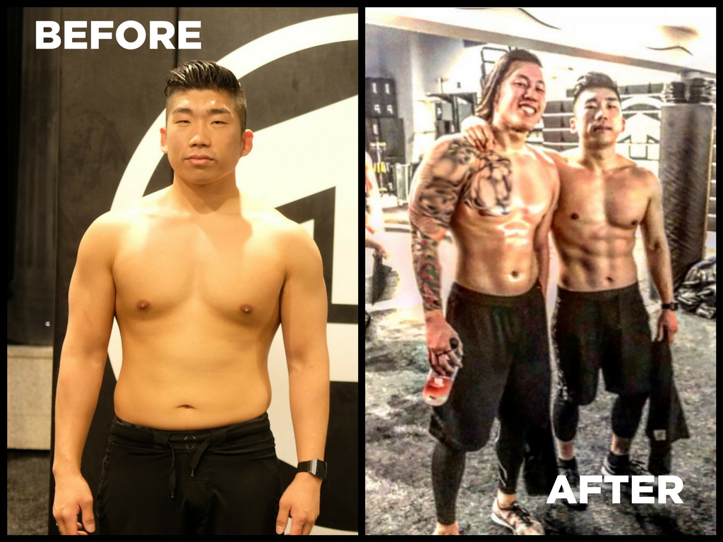louis choi before and after